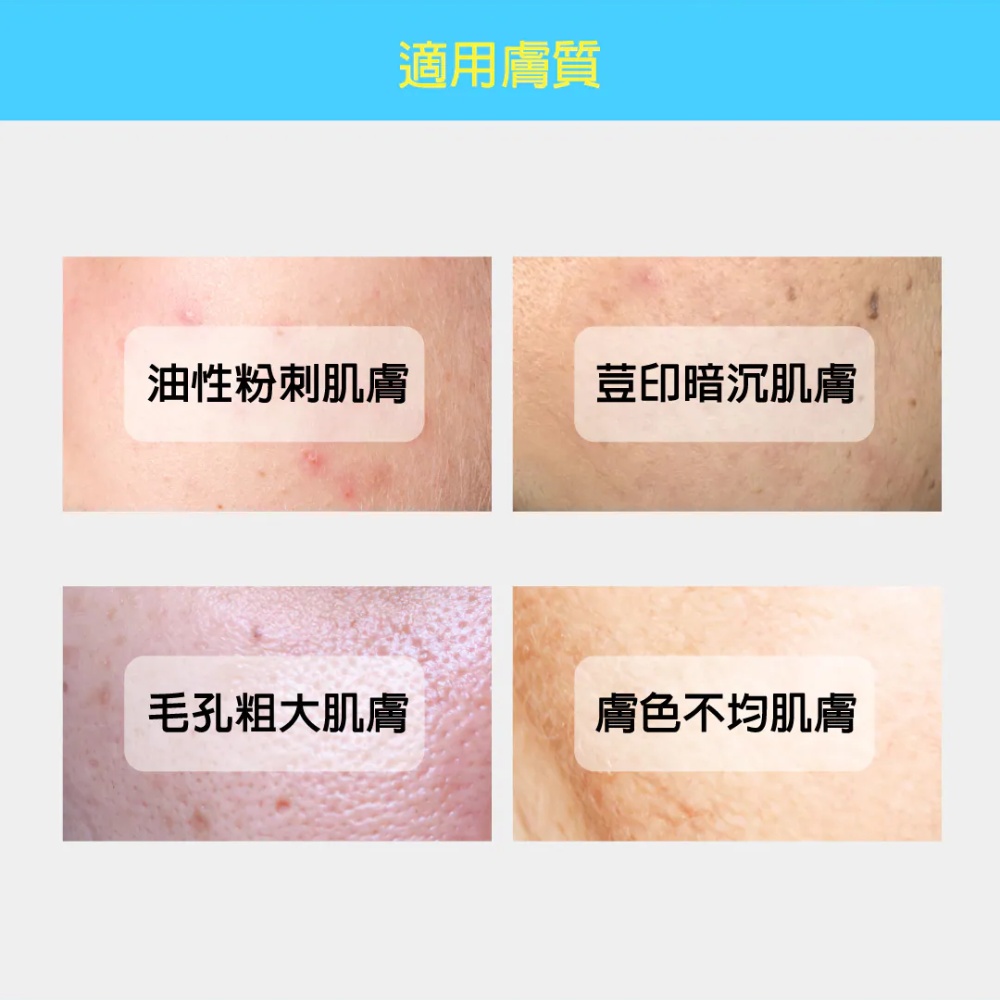 妮傲絲翠 杏仁酸控油淨亮水凝乳
